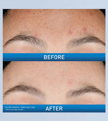 Resurfacing Retinol Serum